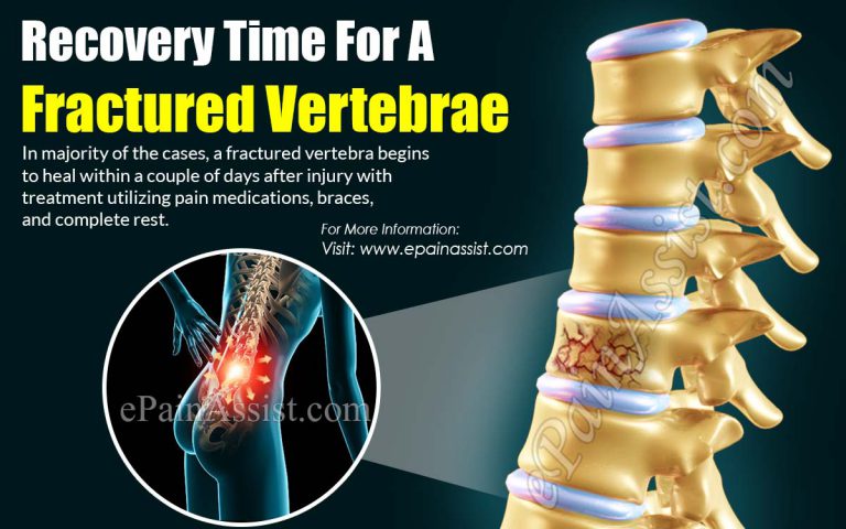 Recovery Time For A Fractured Vertebrae