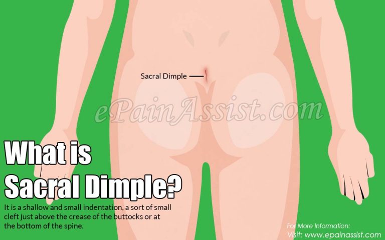Sacral Dimple: Symptoms, Causes, Risk Factors, Treatment, Complications