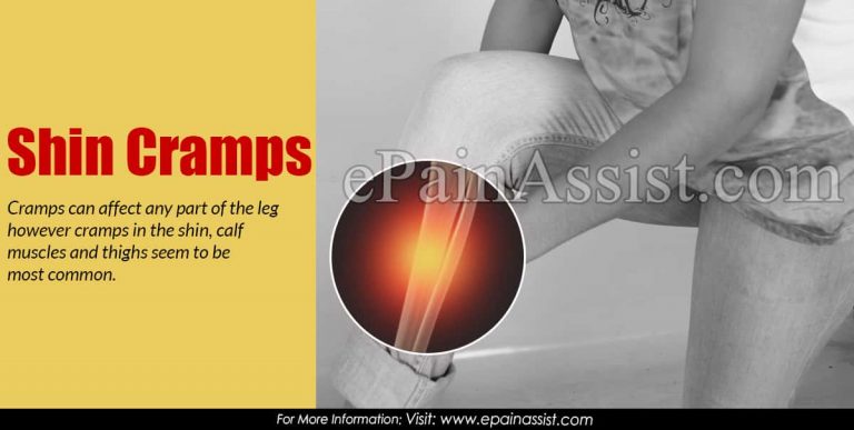 Shin Cramps: Causes, Symptoms, Treatment