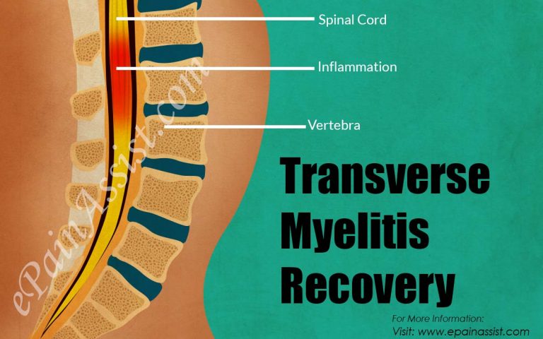 Transverse Myelitis Recovery: How Long Does It Take To Recover?