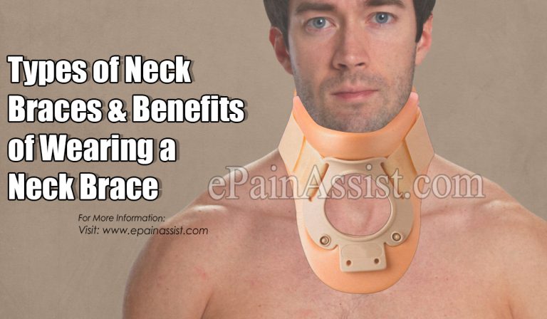 Types of Neck Braces & Benefits of Wearing a Neck Brace