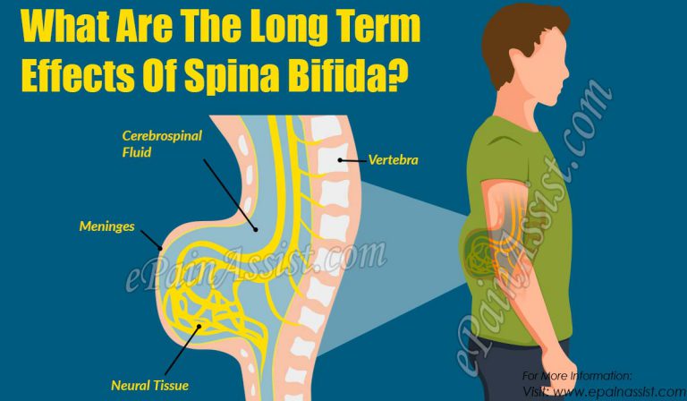 What Are The Long Term Effects Of Spina Bifida?