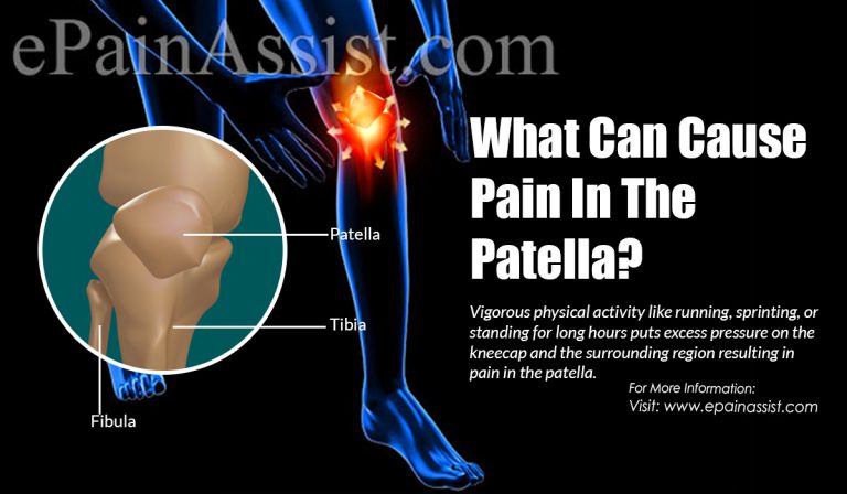 What Can Cause Pain In The Patella & How is it Treated?