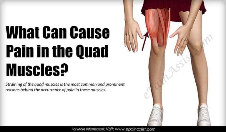 What Can Cause Quad Muscle Pain & What Are Its Treatment, Home Remedies