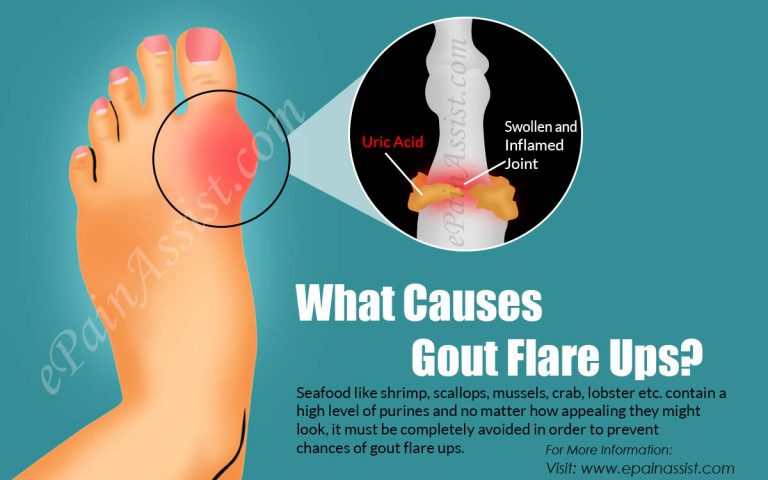 What Causes Gout Flare Ups & How to Get Rid of it?