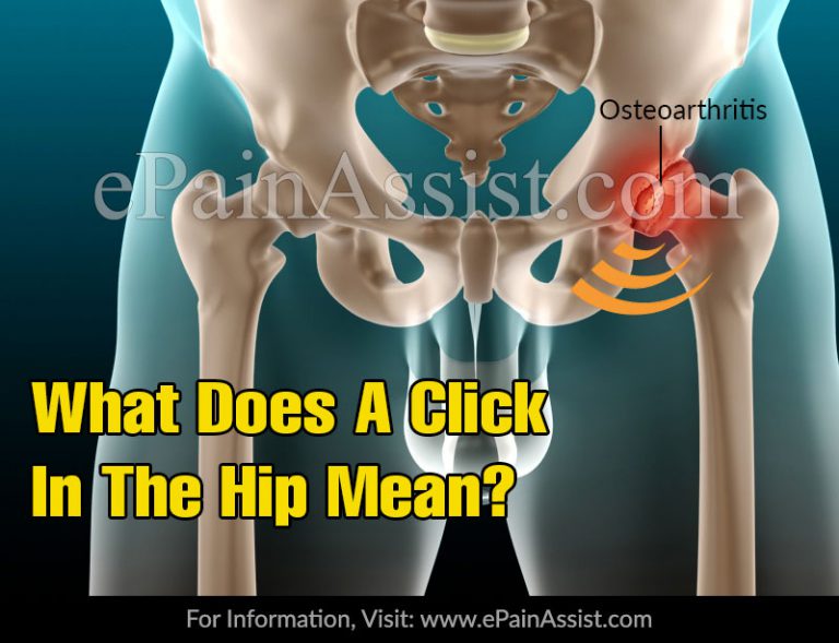 What Does A Click In The Hip Mean?