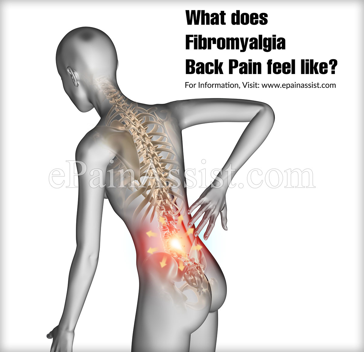 What Does Fibromyalgia Back Pain Feel Like?