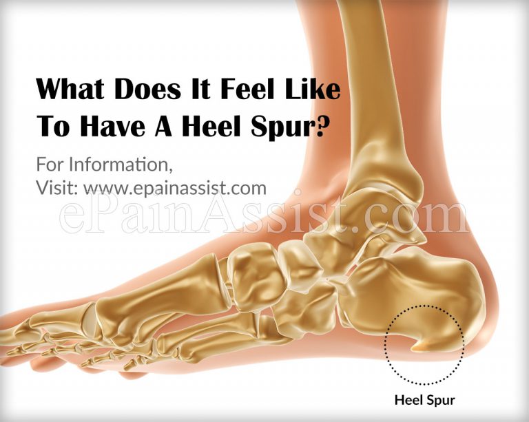 What Does It Feel Like To Have A Heel Spur & What are its Risk Factors?