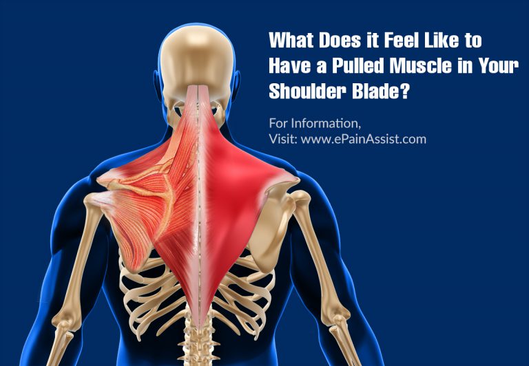 What Does It Feel Like To Have A Pulled Muscle In Your Shoulder Blade?