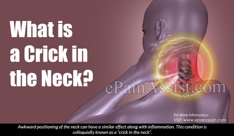 What Is A Crick In The Neck & Ways To Get Rid Of It?