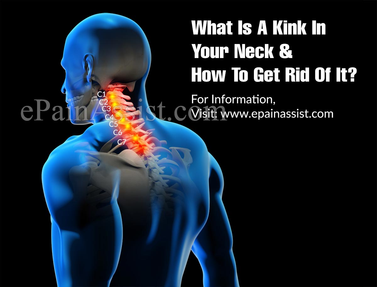 What Is A Kink In Your Neck & How To Get Rid Of It?