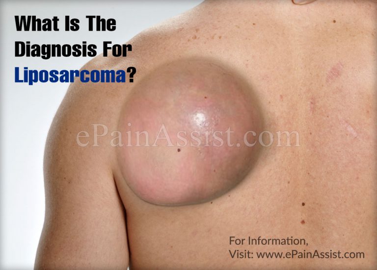 What Is The Diagnosis For Liposarcoma?