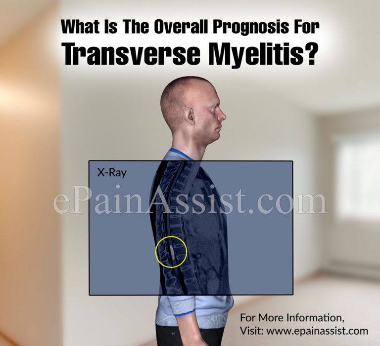 What is the Overall Prognosis for Transverse Myelitis?