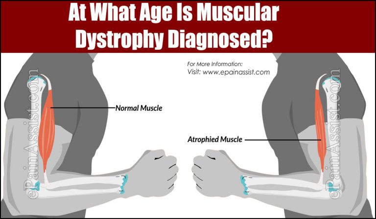 At What Age Is Muscular Dystrophy Diagnosed?