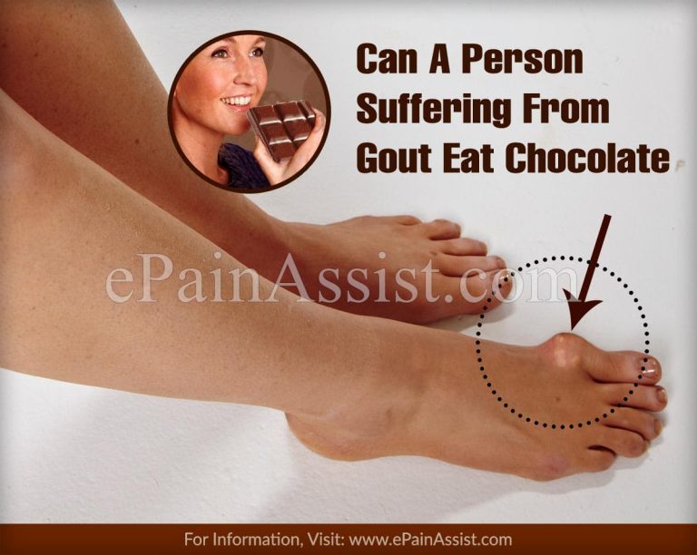 Can A Person Suffering From Gout Eat Chocolate