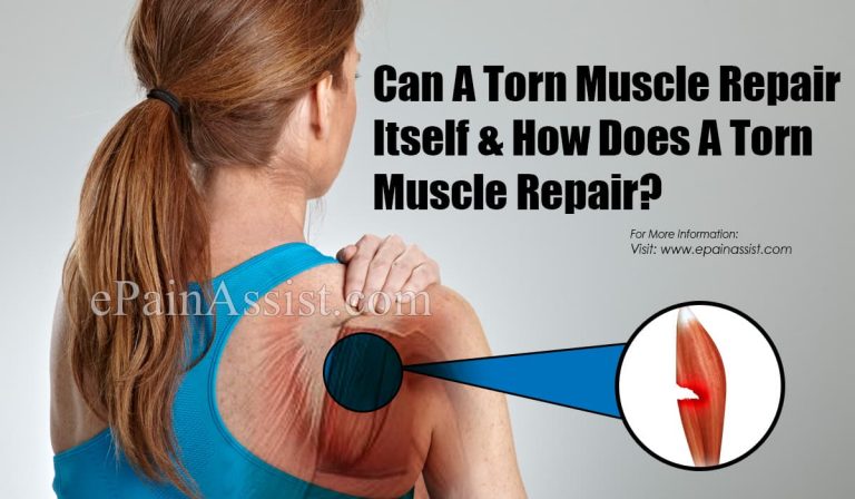 Can A Torn Muscle Repair Itself & How Does A Torn Muscle Repair?