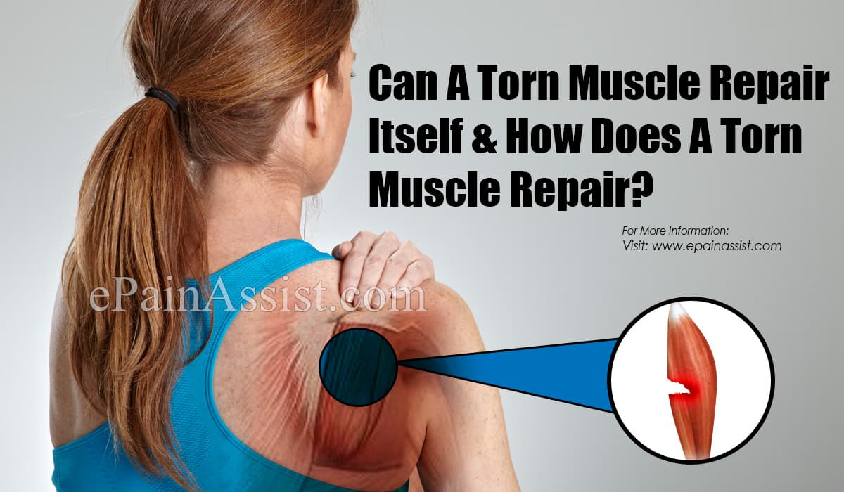 Can A Torn Muscle Repair Itself & How Does A Torn Muscle Repair?