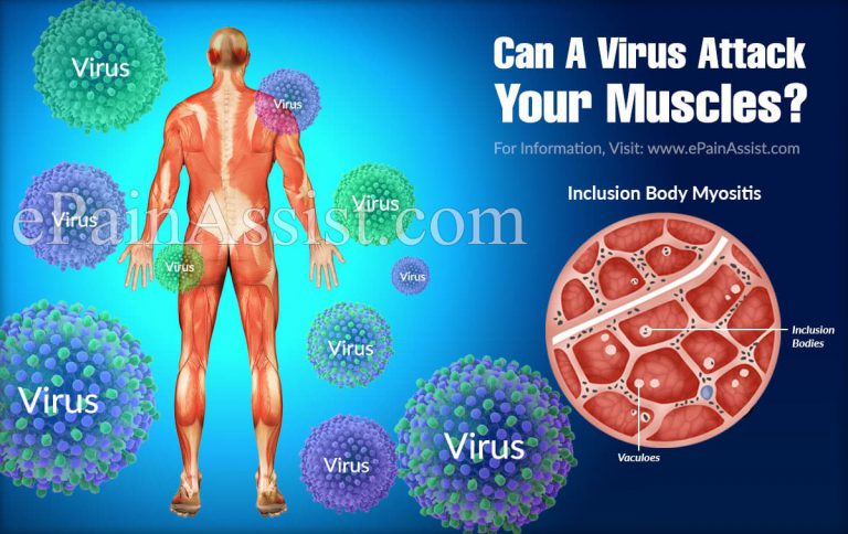 Can A Virus Attack Your Muscles?