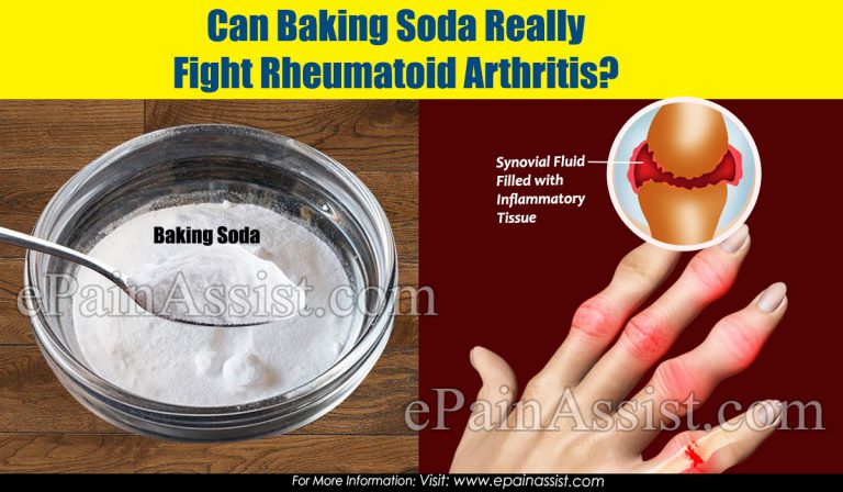 Can Baking Soda Really Fight Rheumatoid Arthritis?
