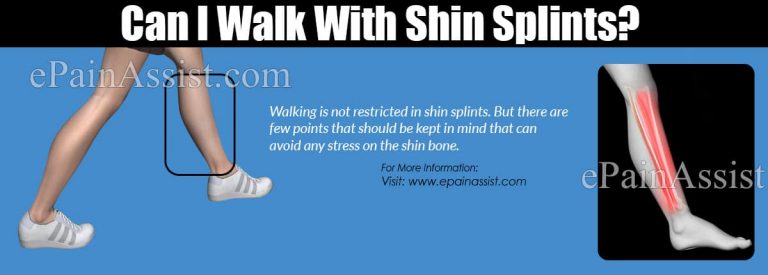 Can I Walk With Shin Splints?