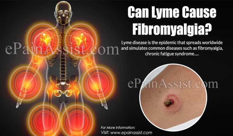 Can Lyme Cause Fibromyalgia?
