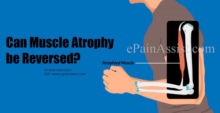 Can Muscle Atrophy Be Reversed?