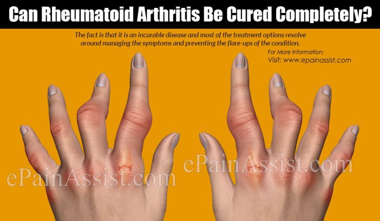 Can Rheumatoid Arthritis Be Cured Completely?|Treatment Options For Rheumatoid Arthritis