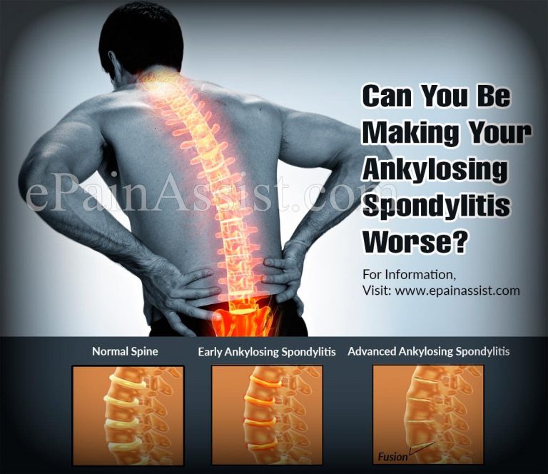 Can You Be Making Your Ankylosing Spondylitis Worse?
