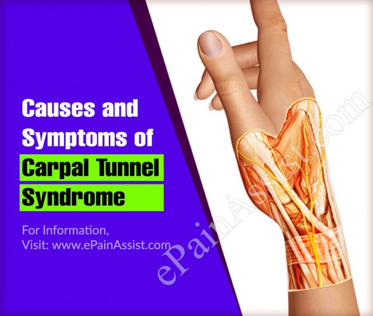 Causes and Symptoms of Carpal Tunnel Syndrome & its Complications, Care