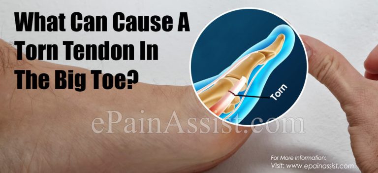 Causes & Symptoms Of Torn Tendon In The Big Toe