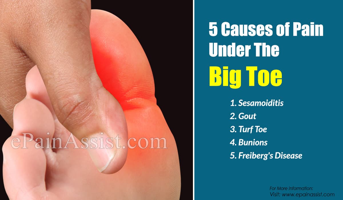 5 Causes of Pain Under The Big Toe