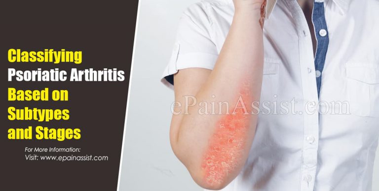 Classifying Psoriatic Arthritis Based on Subtypes and Stages