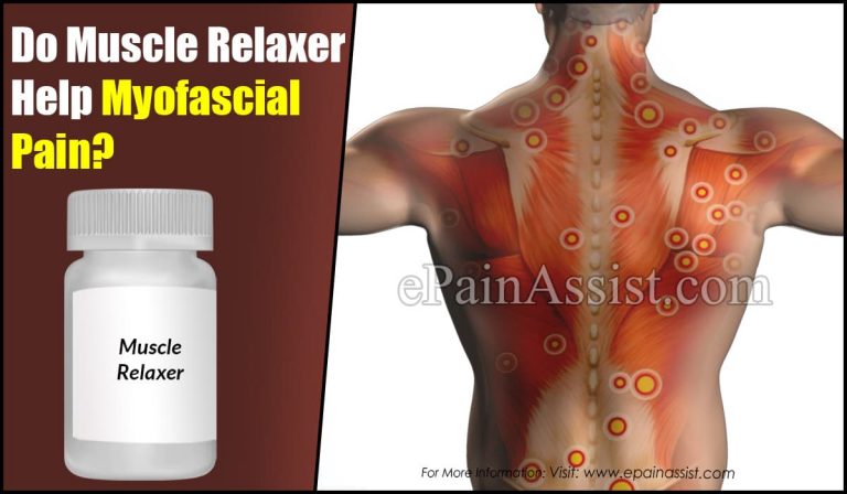 Do Muscle Relaxers Help Myofascial Pain?