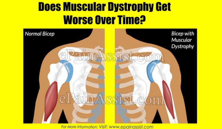 Does Muscular Dystrophy Get Worse Over Time?
