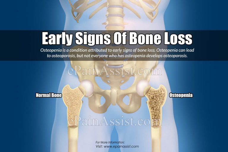 Early Signs Of Bone Loss