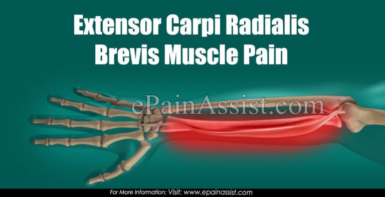 Extensor Carpi Radialis Brevis Muscle Pain: Causes, Treatment, Signs, Symptoms, Risk Factors