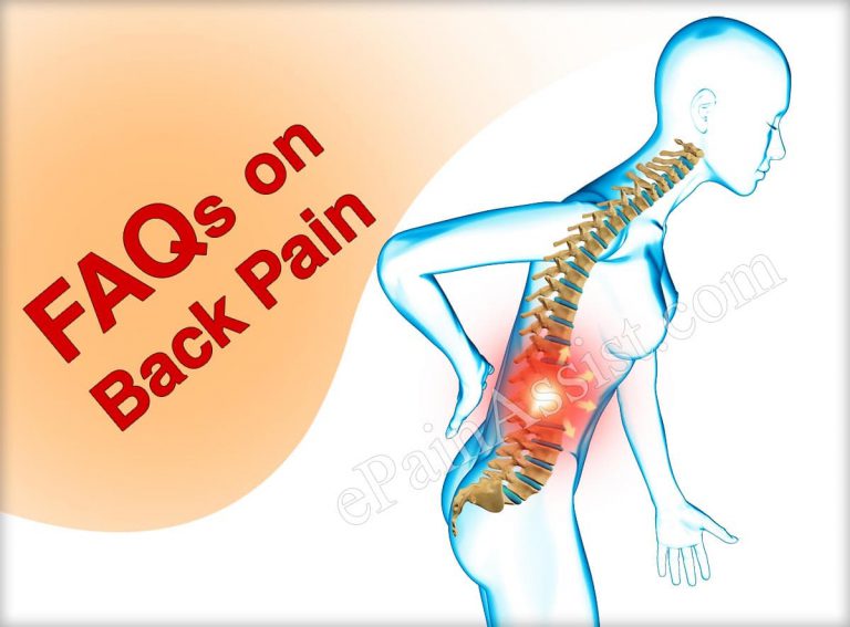 FAQs on Back Pain