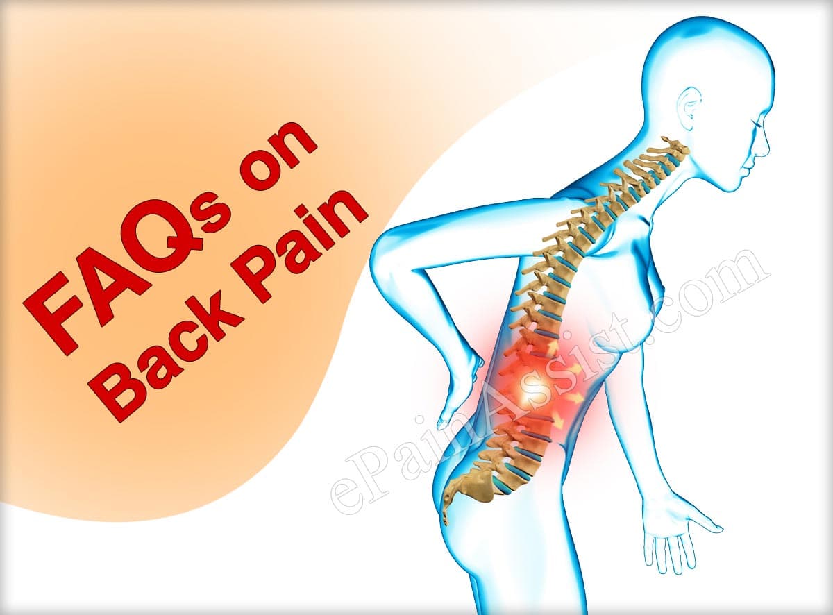 FAQs on Back Pain