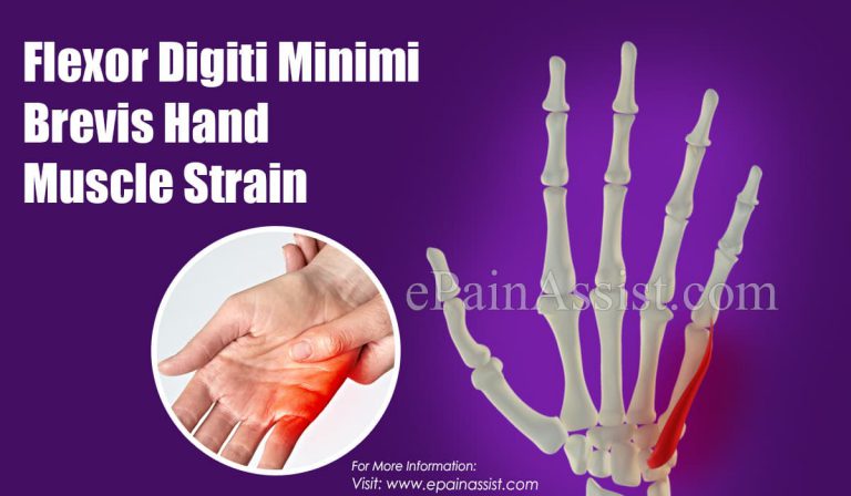 Flexor Digiti Minimi Brevis Hand Muscle Strain: Causes, Treatment, Signs, Symptoms, Risk Factors