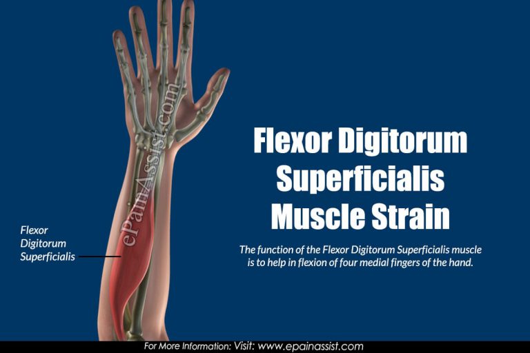 Flexor Digitorum Superficialis Muscle Strain: Causes, Treatment, Signs, Symptoms, Risk Factors