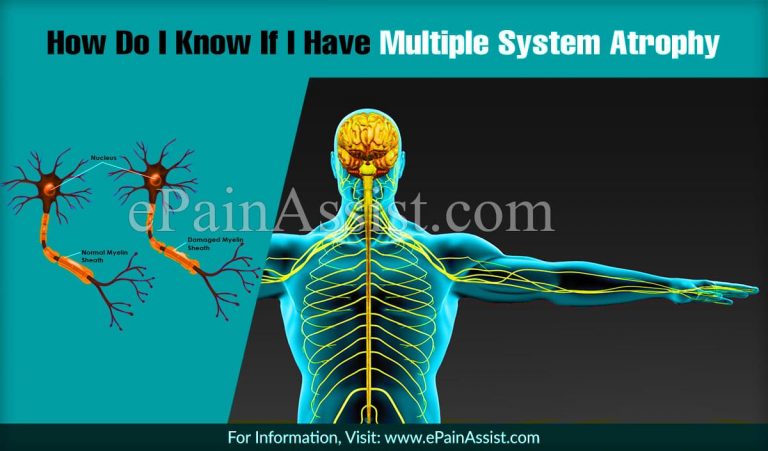 How Do I Know If I Have Multiple System Atrophy & What Are Its Types?