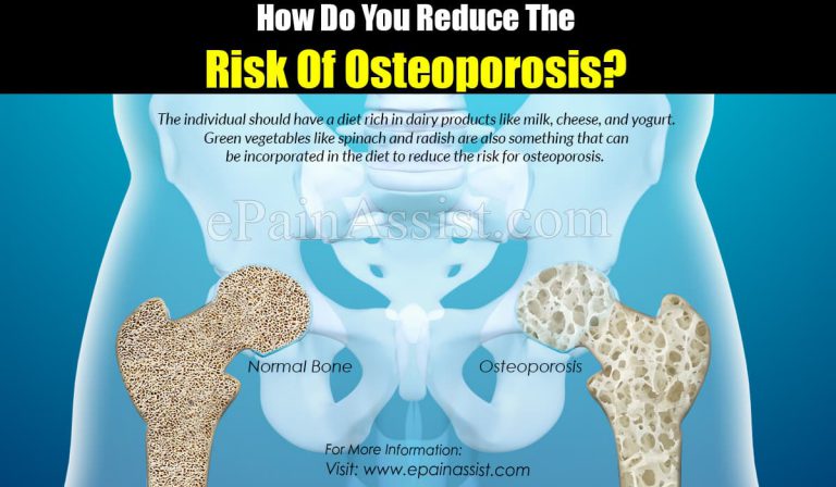 How Do You Reduce The Risk Of Osteoporosis?