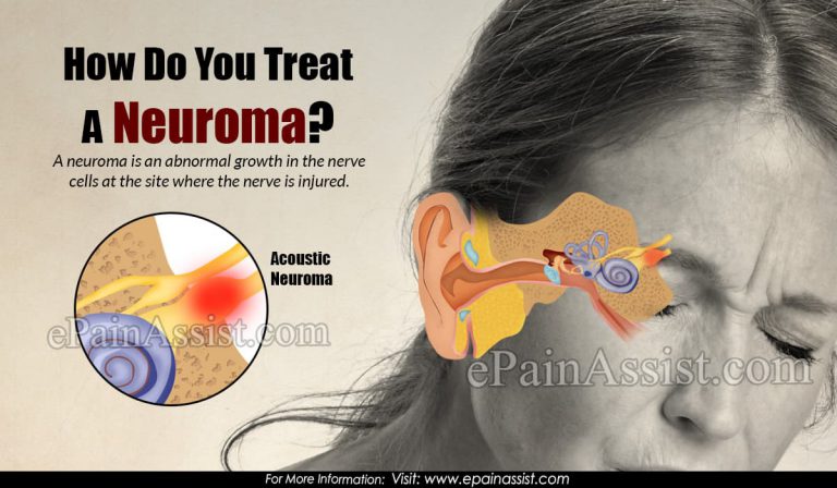 How Do You Treat A Neuroma On The Ball Of Your Foot?