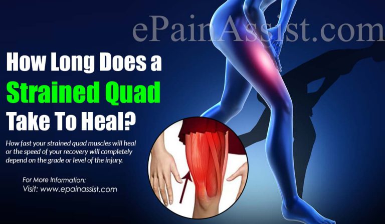 How Long Does a Strained Quad Take To Heal?