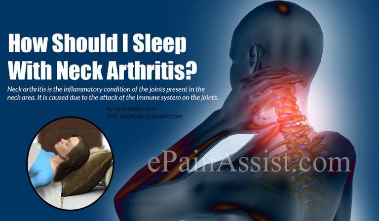 How Should I Sleep With Neck Arthritis?