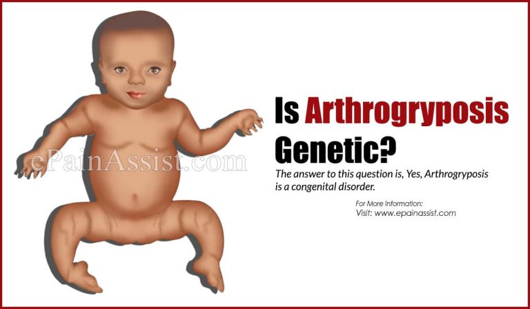 Is Arthrogryposis Genetic?