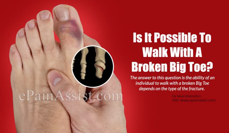 Is It Possible To Walk With A Broken Big Toe?
