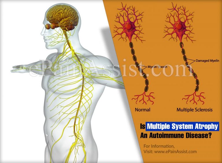 Is Multiple System Atrophy An Autoimmune Disease?