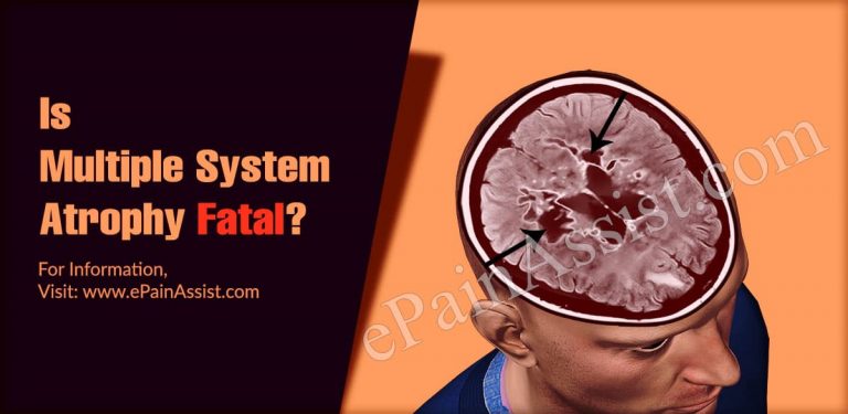 Is Multiple System Atrophy Fatal?