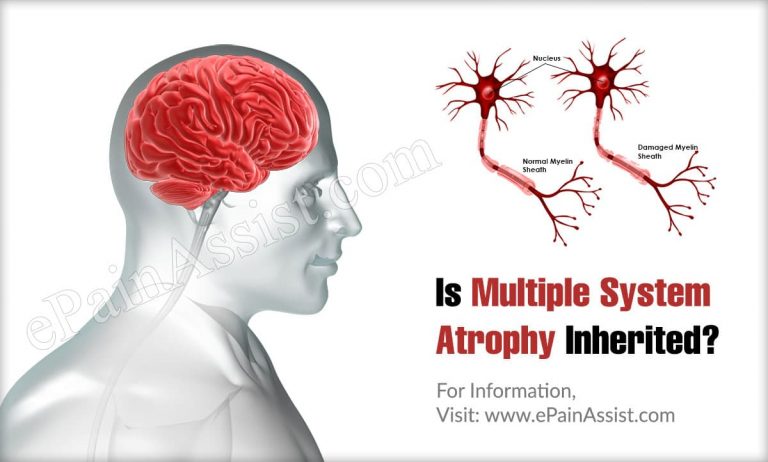 Is Multiple System Atrophy Inherited?